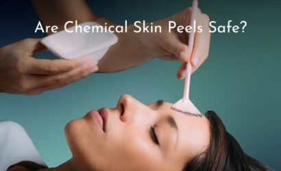 Are Chemical Skin Peels Safe? birmingham
