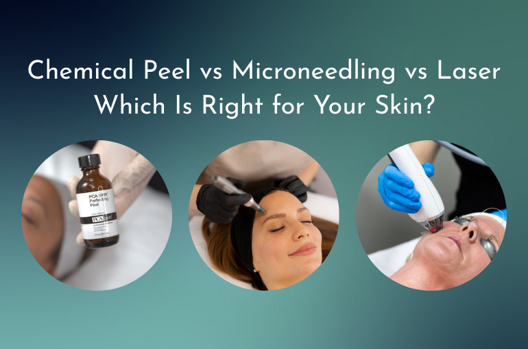 Comparison of chemical peel, microneedling, and laser skin treatments for skin rejuvenation