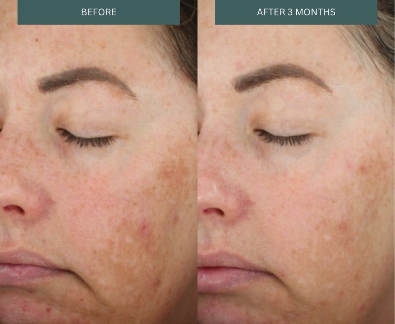 DiamondGlow Before and After Birmingham