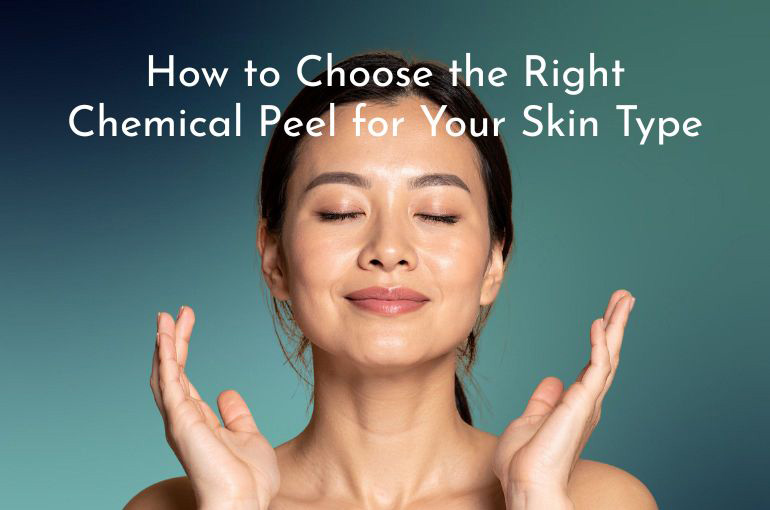 How to Choose the Right Chemical Peel for Your Skin Type