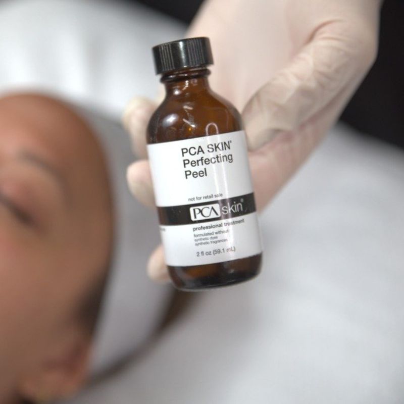 PCA skin peel treatment birmingham