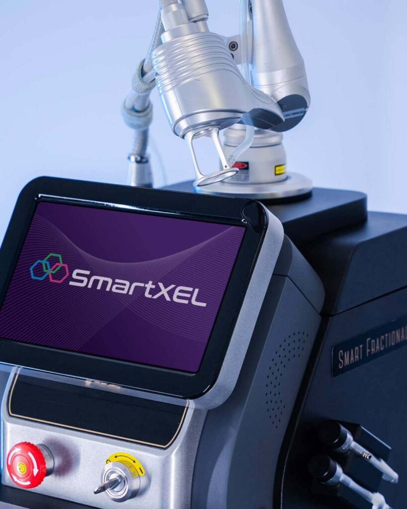 SmartXEL CO2 Laser Machine Birmingham