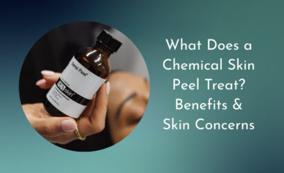 Chemical skin peel treatment targeting acne, pigmentation, fine lines and uneven skin tone