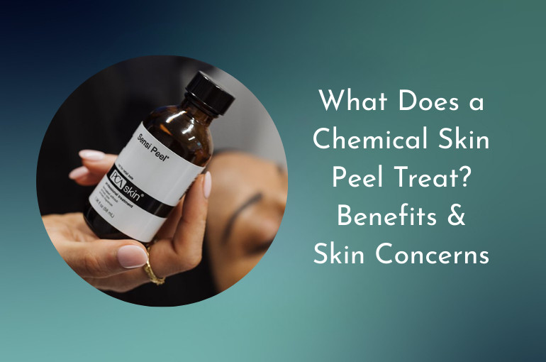 Chemical skin peel treatment targeting acne, pigmentation, fine lines and uneven skin tone