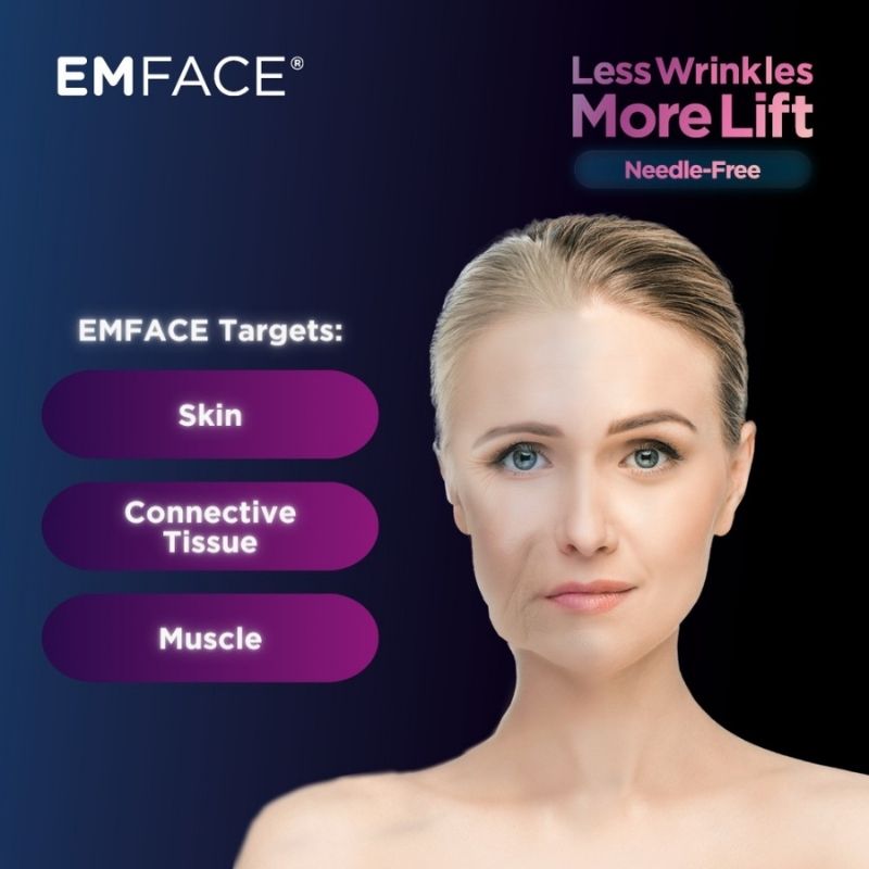 Where Emface treatment targets birmingham