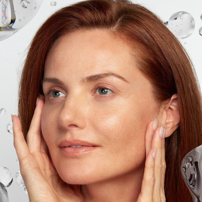 after profhilo structura treatment in birmingham