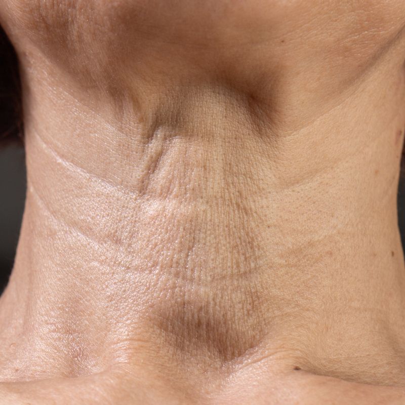 ageing neck treatments in birmingham