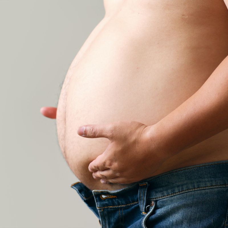 before weight loss journey birmingham