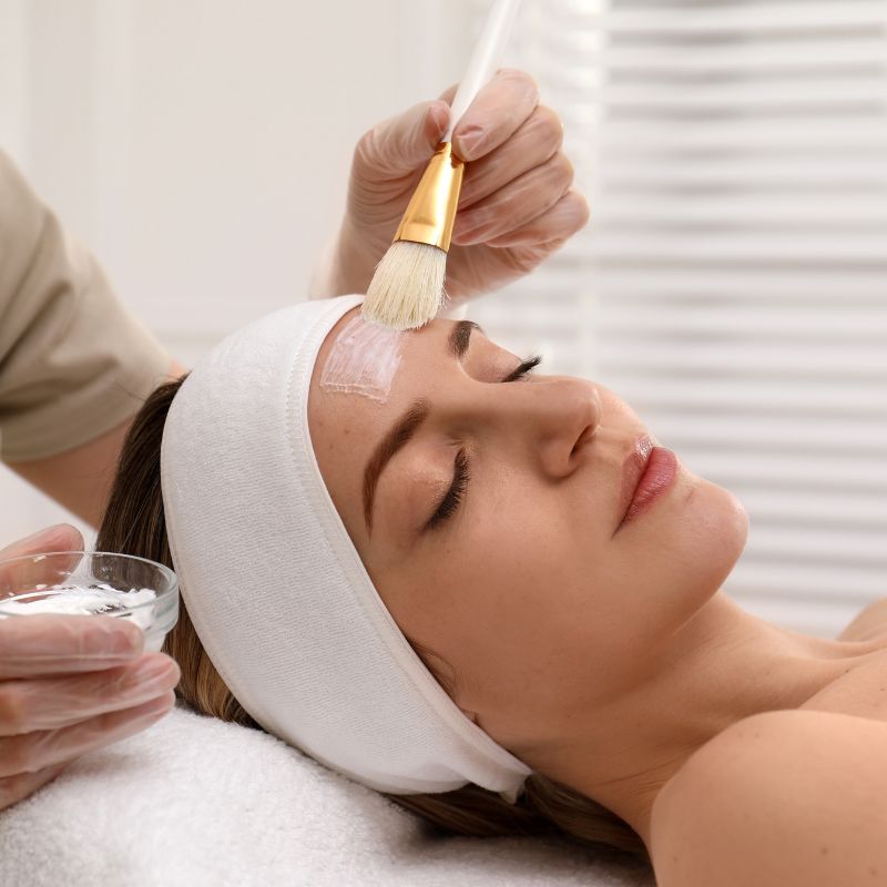 chemical skin peel application in birmingham