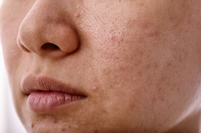 dull skin condition treatment birmingham