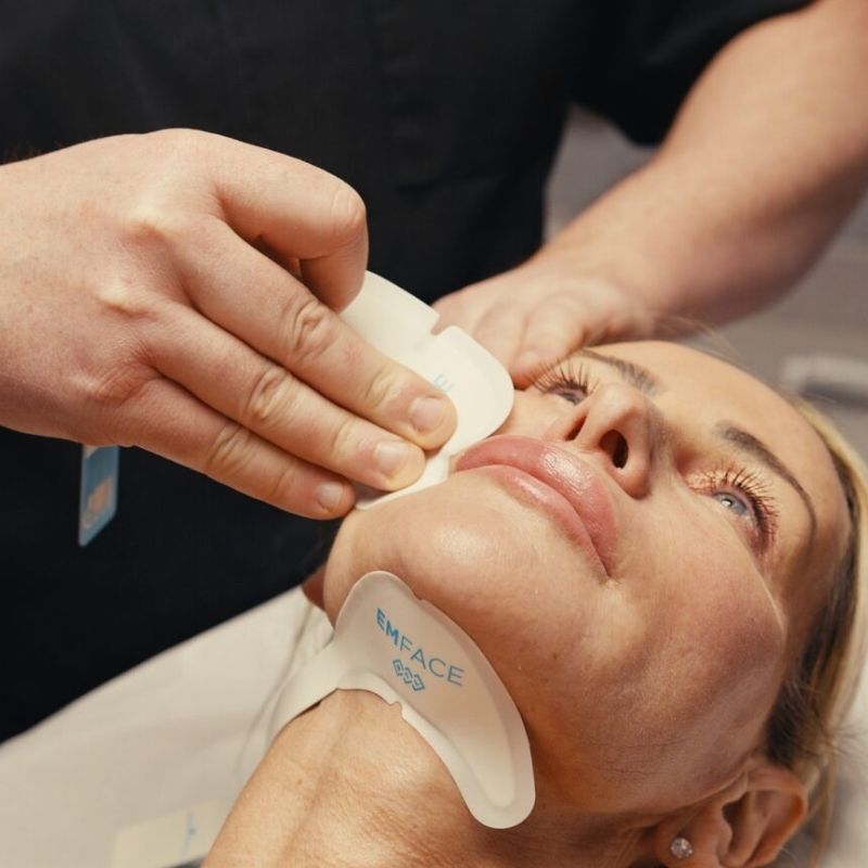 emface treatment in birmingham