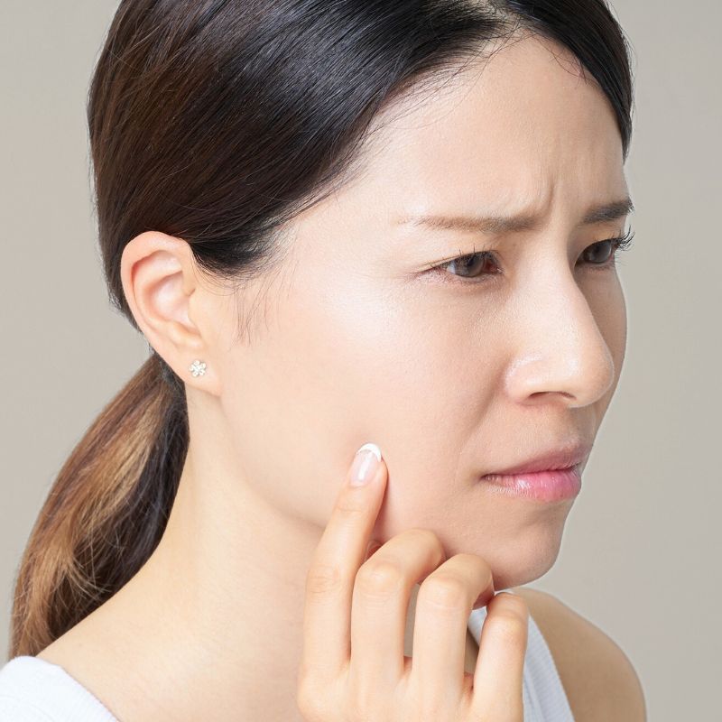 fractional co2 laser treatment areas birmingham