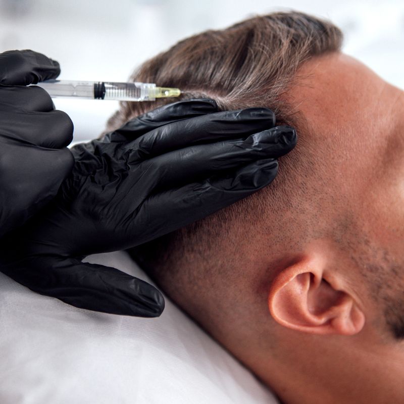 hair restoration treatment birmingham