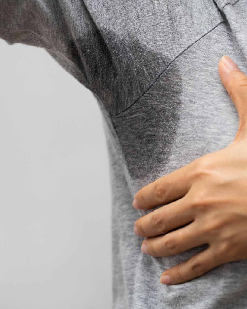 hyperhidrosis condition before treatment birmingham