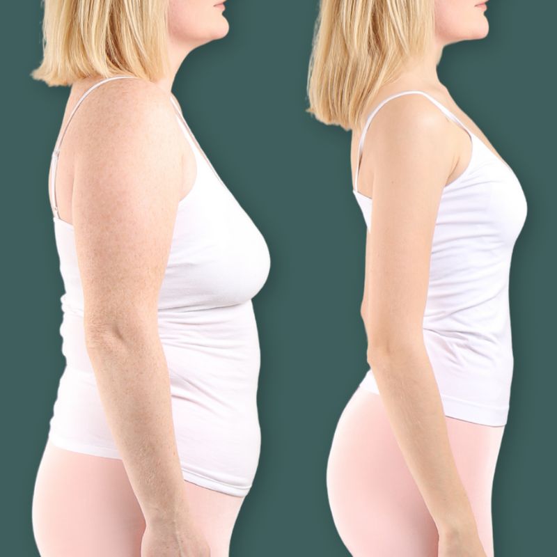 mounjaro before and after side results birmingham