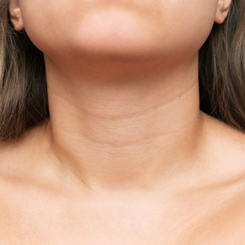 neck treatments birmingham