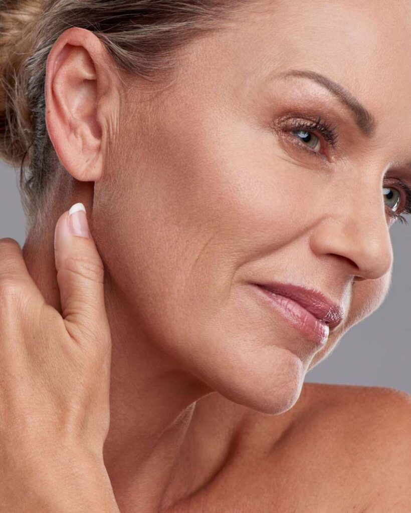 profhilo structura treatment in birmingham