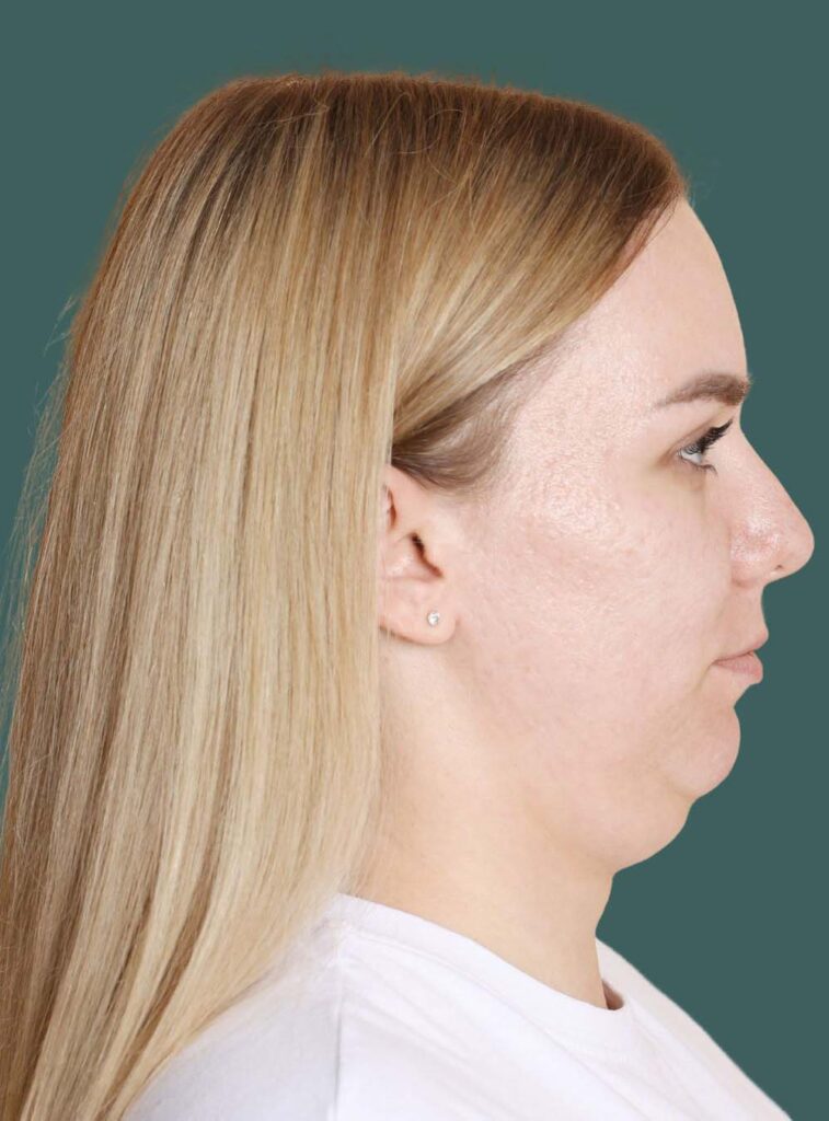 side profile neck treatments birmingham