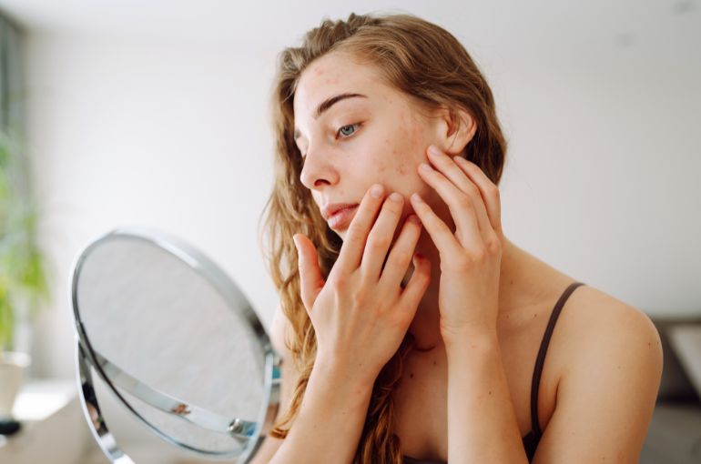 skin concerns treatment in birmingham