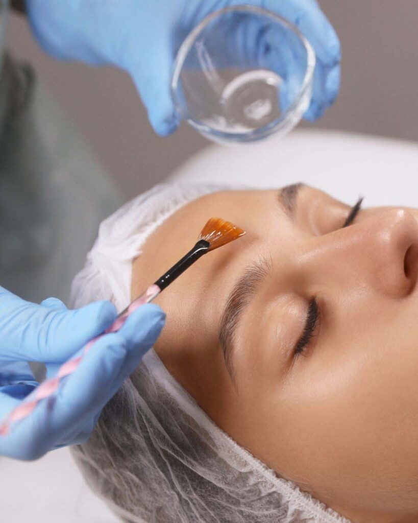 skin peel treatment birmingham