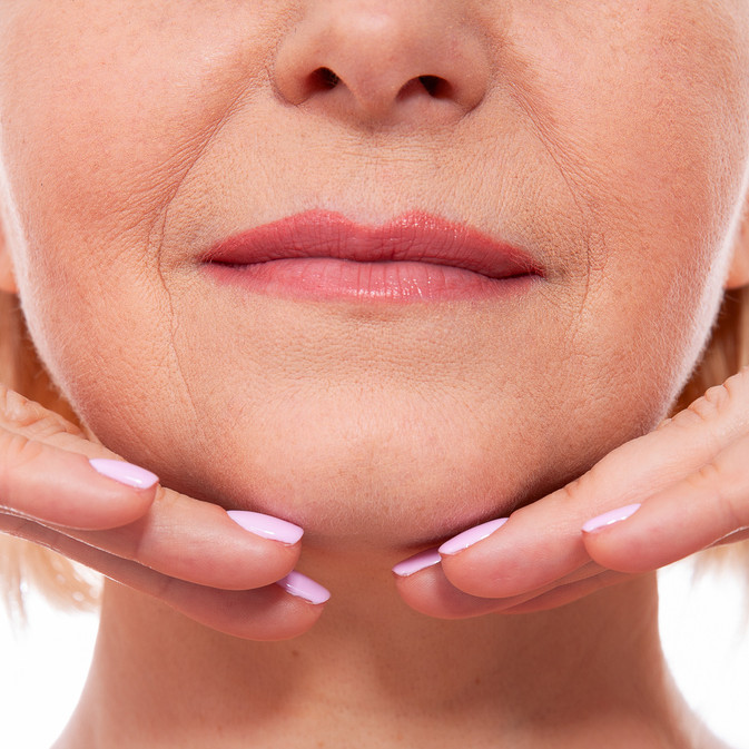 marionette lines and nasolabial folds in birmingham