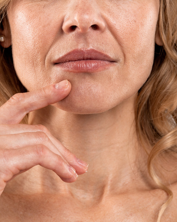 nasolabial folds condition in birmingham