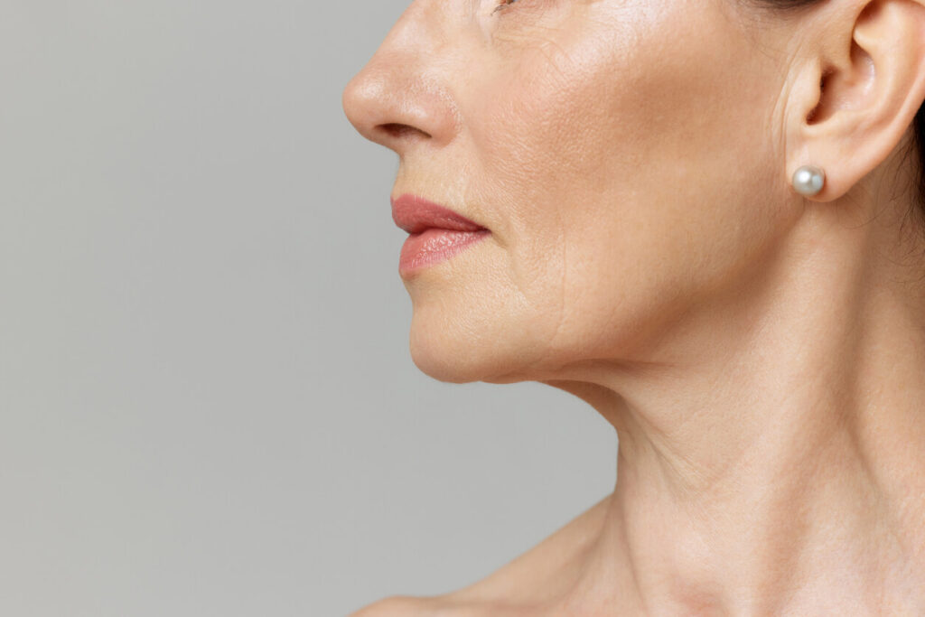 jawline filler sagging jaw