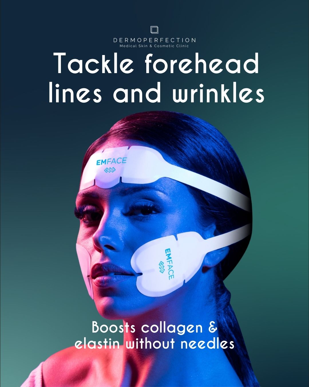 Advertisement for EMFACE treatment to reduce forehead lines and wrinkles on a woman's face with applicators visible.